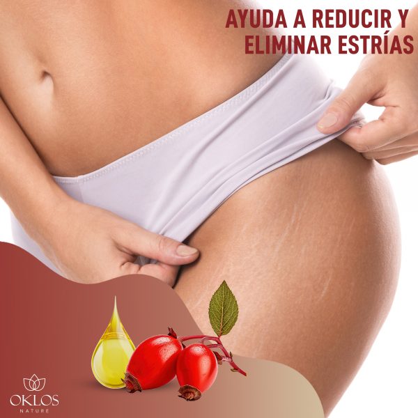 Aceite de Rosa Mosqueta – Regenera, reafirma y transforma tu piel visiblemente - Imagen 6