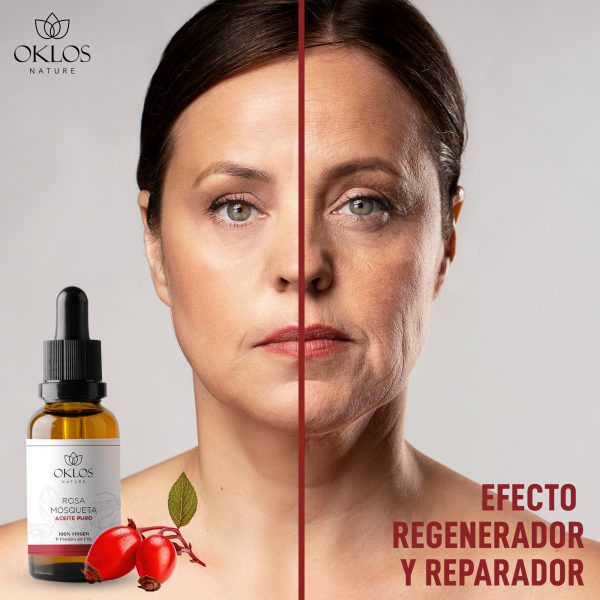 Aceite de Rosa Mosqueta – Regenera, reafirma y transforma tu piel visiblemente - Imagen 7